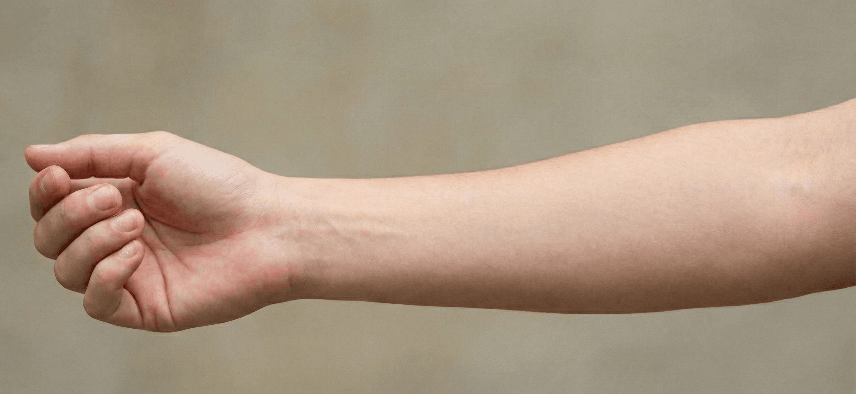 Original Photo - Before